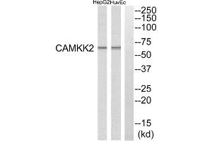 Western blot analysis of extracts from HuvEc cells and HepG2 cells, using CAMKK2 antibody. (CAMKK2 抗体  (Internal Region))
