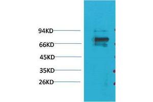 Western Blot (WB) analysis of 293T with KV1. (KCNA5 抗体)