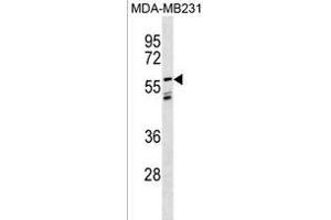 LGI3 Antibody (Center) (ABIN1881494 and ABIN2838431) western blot analysis in MDA-M cell line lysates (35 μg/lane). (LGI3 抗体  (AA 310-338))
