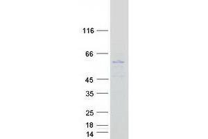 Validation with Western Blot