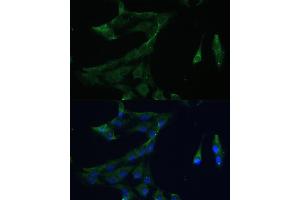 Immunofluorescence analysis of C6 cells using  Polyclonal Antibody (ABIN7265493) at dilution of 1:100 (40x lens). (ARL3 抗体  (AA 1-182))