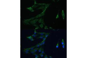 Immunofluorescence analysis of C6 cells using  Polyclonal Antibody (ABIN7265493) at dilution of 1:100 (40x lens). (ARL3 抗体  (AA 1-182))