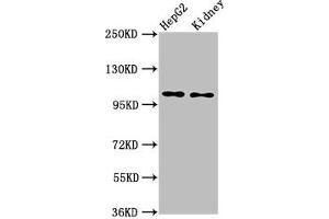 Western Blot Positive WB detected in: HepG2 whole cell lysate, Rat kidney tissue All lanes: PCSK5 antibody at 6 μg/mL Secondary Goat polyclonal to rabbit IgG at 1/50000 dilution Predicted band size: 207, 102 kDa Observed band size: 102 kDa