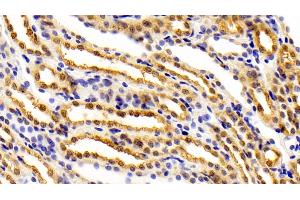 Detection of FEz2 in Rat Kidney Tissue using Polyclonal Antibody to Fasciculation And Elongation Protein Zeta 2 (FEz2) (FEZ2 抗体  (AA 1-375))