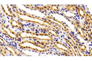 Detection of FEz2 in Rat Kidney Tissue using Polyclonal Antibody to Fasciculation And Elongation Protein Zeta 2 (FEz2) (FEZ2 抗体  (AA 1-375))