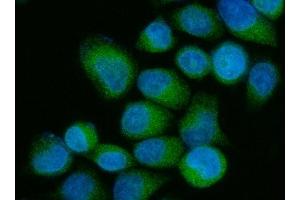 IF analysis of OS9 using anti-OS9 antibody (ABIN7602048).
