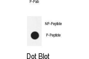 Dot blot analysis of anti-Phospho-AKT1- Antibody Phospho-specific Pab (ABIN650890 and ABIN2839832) on nitrocellulose membrane.