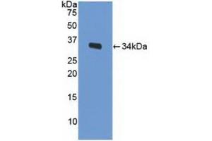 Detection of Recombinant LRP1, Mouse using Polyclonal Antibody to Low Density Lipoprotein Receptor Related Protein 1 (LRP1) (LRP1 抗体  (AA 692-962))