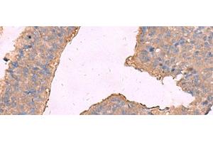 Immunohistochemistry (Paraffin-embedded Sections) (IHC (p)) image for anti-Potassium Intermediate/small Conductance Calcium-Activated Channel, Subfamily N, Member 2 (KCNN2) antibody (ABIN7245449)