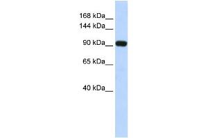 WB Suggested Anti-EVI1 Antibody Titration: 0. (MECOM 抗体  (Middle Region))