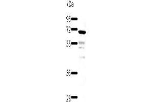 Gel: 8+10+12 % SDS-PAGE, Lysate: 60 μg, Lane: Human fetal kidney tissue, Primary antibody: ABIN7192878(TRAF3 Antibody) at dilution 1/500, Secondary antibody: Goat anti rabbit IgG at 1/8000 dilution, Exposure time: 40 seconds (TRAF3 抗体)