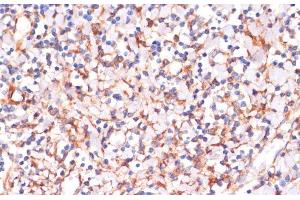 Immunohistochemistry of paraffin-embedded Human tonsil using IKK alpha Polyclonal Antibody at dilution of 1:100 (40x lens). (IKK alpha 抗体)