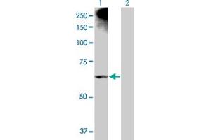 Western Blot analysis of ALOX12 expression in transfected 293T cell line by ALOX12 MaxPab polyclonal antibody. (ALOX12 抗体  (AA 1-663))