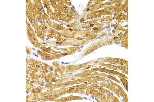 Immunohistochemistry of paraffin-embedded Mouse heart using CSRP3 antibody at dilution of 1:100 (x400 lens). (CSRP3 抗体)