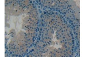Immunohistochemistry (IHC) image for anti-Osteocalcin (BGLAP) (AA 14-95) antibody (ABIN7431830)