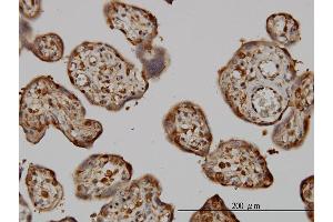 Immunostaining (ISt) image for anti-Non-Metastatic Cells 1, Protein (NM23A) Expressed in (NME1) (AA 43-152) antibody (ABIN562004)
