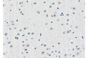 ABIN6257957 and ABIN6275973 at 1/100 staining Rat brain tissue by IHC-P. (BAI1 抗体  (Internal Region))