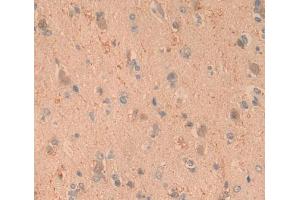 Used in DAB staining on fromalin fixed paraffin- embedded brain tissue (ARTN 抗体)