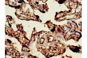 Immunohistochemistry of paraffin-embedded human placenta tissue using ABIN7144564 at dilution of 1:100 (ARAP1 抗体  (AA 69-344))