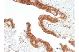 Immunohistochemistry (IHC) image for anti-5'-Nucleotidase, Ecto (CD73) (NT5E) antibody (ABIN6940227)