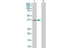 Lane 1: GIPC1 transfected lysate ( 36 KDa) Lane 2: Non-transfected lysate.