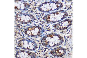 Immunohistochemistry of paraffin-embedded Human colon using TEX101 Rabbit pAb (ABIN7270773) at dilution of 1:100 (40x lens). (TEX101 抗体)