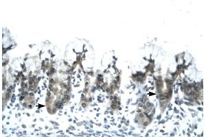 ACDC antibody was used for immunohistochemistry at a concentration of 4-8 ug/ml to stain Epithelial cells of fundic gland (arrows) in Human Stomach. (ADIPOQ 抗体  (N-Term))