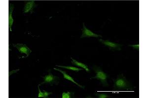 Immunofluorescence of monoclonal antibody to WBP2 on HeLa cell. (WBP2 抗体  (AA 1-261))