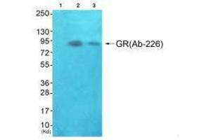 Western blot analysis of extracts from JK cells (Lane 2) and K562 cells (Lane 3), using GR(Ab-226) antiobdy. (Glucocorticoid Receptor 抗体  (Ser226, Ser234, Ser246))