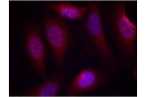 Image no. 3 for anti-Mitogen-Activated Protein Kinase Kinase 4 (MAP2K4) (pSer80) antibody (ABIN196911) (MAP2K4 抗体  (pSer80))