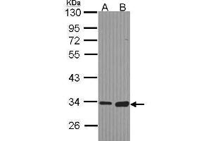WB Image Sample (30 ug of whole cell lysate) A: Hela B: Hep G2 , 10% SDS PAGE antibody diluted at 1:1000 (MGLL 抗体)
