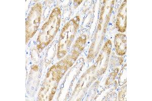 Immunohistochemistry of paraffin-embedded mouse kidney using IKBKAP Rabbit pAb (ABIN6130369, ABIN6142278, ABIN6142279 and ABIN6214265) at dilution of 1:100 (40x lens). (IKAP/p150 抗体  (AA 1093-1332))