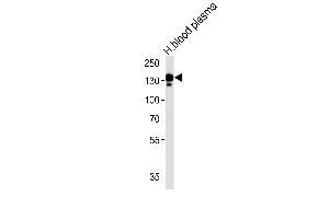 CP Antibody (N-term) (ABIN391512 and ABIN2841473) western blot analysis in human blood plasma tissue lysates (35 μg/lane). (Ceruloplasmin 抗体  (N-Term))