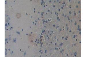 Detection of REG3b in Mouse Cerebrum Tissue using Polyclonal Antibody to Regenerating Islet Derived Protein 3 Beta (REG3b) (REG3B 抗体  (AA 27-175))