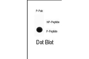 Dot blot analysis of anti-Phospho-ENT1(Slc29a1)-p Antibody (ABIN389998 and ABIN2839775) on nitrocellulose membrane. (SLC29A1 抗体  (pSer254))