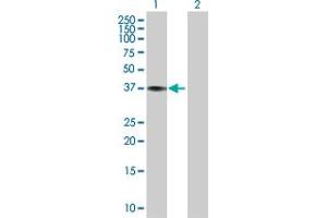 Western Blot analysis of CTSK expression in transfected 293T cell line by CTSK MaxPab polyclonal antibody. (Cathepsin K 抗体  (AA 1-329))