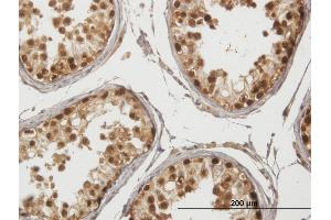 Immunoperoxidase of purified MaxPab antibody to GAGE1 on formalin-fixed paraffin-embedded human testis. (G Antigen 1 抗体  (AA 1-139))