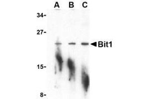 Western blot analysis of Bit1 in A-20 cell lysate with AP30152PU-N Bit1 antibody at (A) 1, (B) 2, and (C) 4 μg/ml. (PTRH2 抗体  (N-Term))