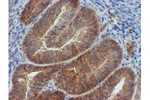 Image no. 6 for anti-Mannose Phosphate Isomerase (MPI) antibody (ABIN1499545) (MPI 抗体)