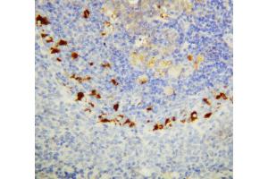 Anti-SOCS1 antibody, IHC(P) IHC(P): Rat Spleen Tissue (SOCS1 抗体  (C-Term))