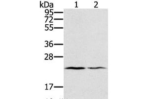 Western Blot analysis of Human normal right lung and normal left lung tissue using EDN2 Polyclonal Antibody at dilution of 1:600 (Endothelin 2 抗体)