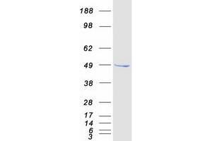 Western Blotting (WB) image for SET Domain Containing (Lysine Methyltransferase) 7 (SETD7) protein (Myc-DYKDDDDK Tag) (ABIN2731875)
