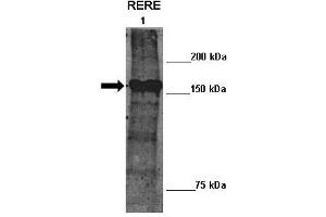 Lanes :  Lane 1: 10ug mouse ATN2 transfected Drosophila extract   Primary Antibody Dilution :   1:100    Secondary Antibody :  Anti-rabbit-HRP   Secondary Antibody Dilution :   1:2000   Gene Name :  RERE   Submitted by :  Manolis Fanto, King's College London (RERE 抗体  (N-Term))