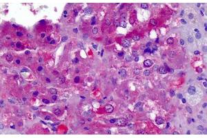 Human Adrenal: Formalin-Fixed, Paraffin-Embedded (FFPE) (APOA2 抗体  (AA 1-100))