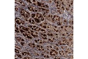 Immunohistochemical staining of human stomach with ADAMTS10 polyclonal antibody  shows strong cytoplasmic positivity in glandular cells at 1:10-1:20 dilution. (ADAMTS10 抗体)