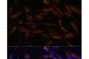 Immunofluorescence analysis of C6 cells using CD44 Polyclonal Antibody at dilution of 1:100. (CD44 抗体)
