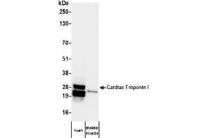 Western Blotting (WB) image for anti-Cardiac Troponin I (TNNI3) antibody (ABIN7795608)