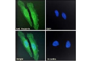 ABIN185127 Immunofluorescence analysis of paraformaldehyde fixed HeLa cells, permeabilized with 0. (Pleckstrin 抗体  (C-Term))