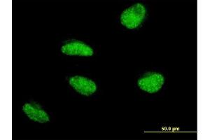 Immunofluorescence of monoclonal antibody to MSH5 on HeLa cell. (MSH5 抗体  (AA 736-835))