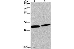 Western blot analysis of Mouse skin tissue and Hela cell, using GJB4 Polyclonal Antibody at dilution of 1:200 (GJB4 抗体)